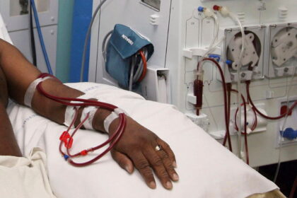 A renal patient undergoing dialysis